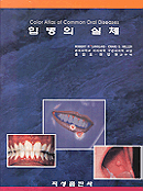 입병의 실체