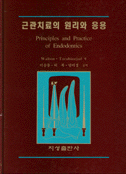근관치료의 원리와 응용
