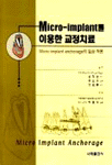 Micro-implant를 이용한 교정치료 : Micro-implant anchorage의 임상 적용