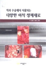 (치과 수술에서 사용되는)다양한 이식 생체재료